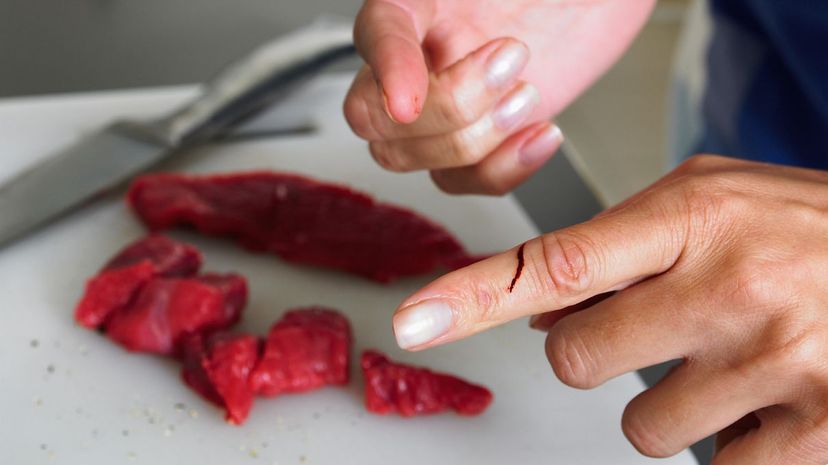 Cut finger cooking
