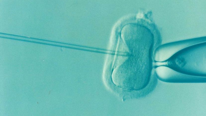 29. The first successful in vitro fertilization