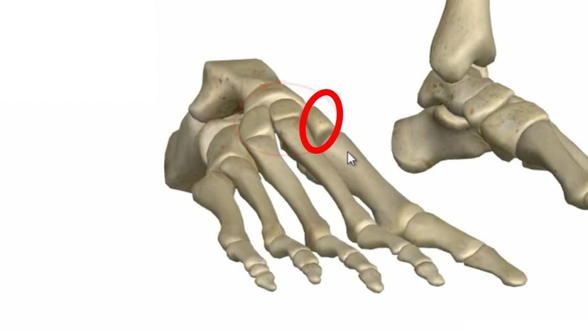 medial cuneiform bone