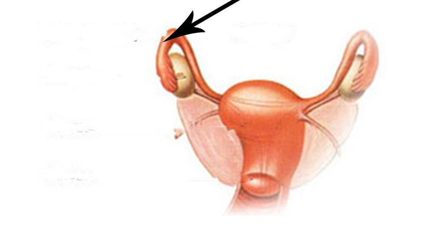 Fallopian Tubes