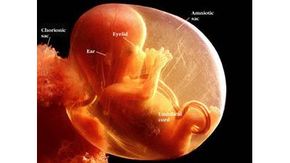 The fetus at 14 weeks