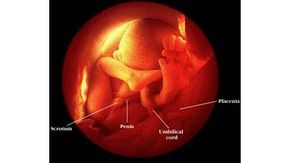 The fetus at 32 weeks