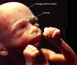 The fetus at 24 weeks