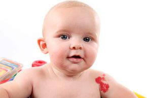A strawberry-shaped birthmark doesn’t mean Mom was overly fond of the red fruit during pregnancy.