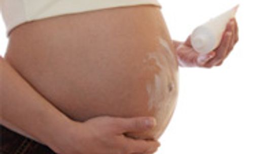 Can you prevent stretch marks when pregnant?