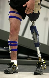 Person with prosthetic limb doing physical therapy