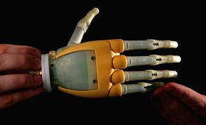 The i-Limb prosthetic hand, from Ossur, has individually powered fingers that allow it to perform different types of grips with improved control.