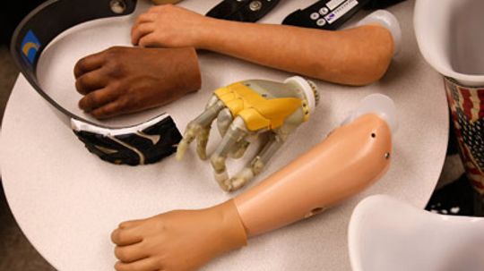 How Prosthetic Limbs Work