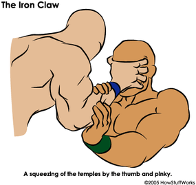 The Iron Claw, or clawhold, was a finishing hold used by old-school Teutonic heels like Baron Von Rothke.