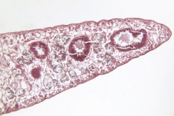 Fasciola hepatica liver fluke