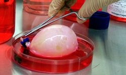 bladder built from stem cells