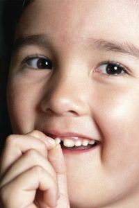 How To Remove Your Kid S Loose Tooth Painlessly Howstuffworks