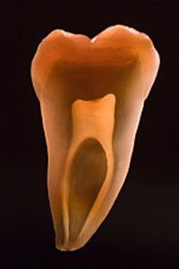 During a root canal, your dentist cleans out the interior of the tooth, shown here in a cross section.