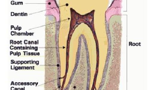 Cavities and Fillings 101