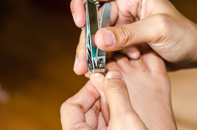 Trimming nails