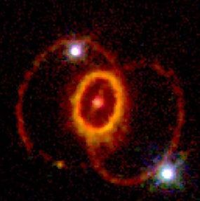 The rings around Supernova 1987A