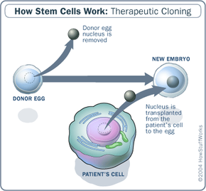 therapeutic cloning diagram