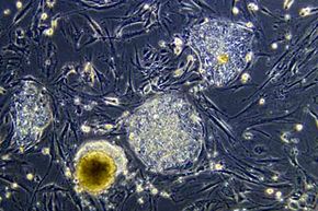 威斯康星大学麦迪逊分校的发育生物学家詹姆斯·汤姆森的研究实验室正在对未分化的人类胚胎干细胞群体进行显微镜观察。＂width=