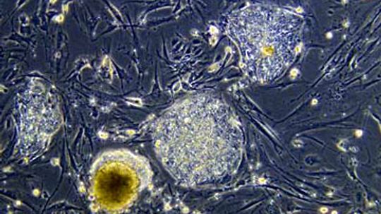 What are stem cells and what are they used for?