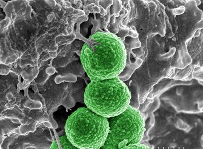 This microscopic bacterium MRSA (Community-Associated MRSA is shown) was responsible for more deaths in 2006 that AIDS.