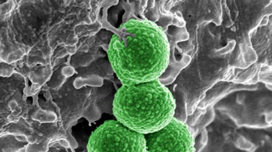 How MRSA Works