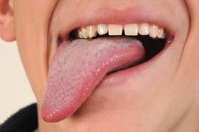 Your tongue may be an extremely flexible muscle, but rest assured it’s firmly attached to your mouth.