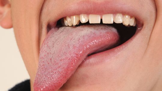 Is it possible to swallow your tongue?