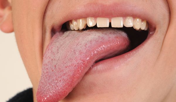 A person sticks out his tongue.