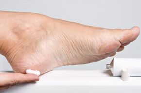 Female hands treating dry feet with moisturizing cream
