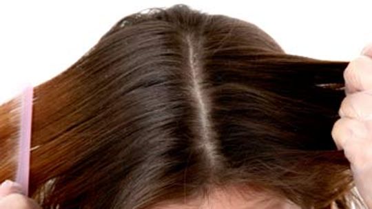 Does my scalp affect the way my hair looks?