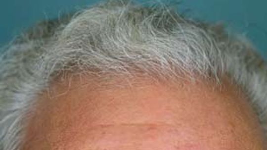 Is the scalp different from other skin?