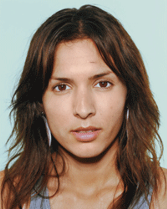 5秘密与化妆品覆盖伤疤”class=