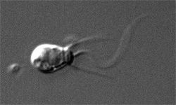 你看到的是一个单一的萨尔平戈卡罗塞塔细胞。S. rosetta是一种颈鞭毛虫，这种微小的生物体有助于研究动物是如何进化的。＂border=