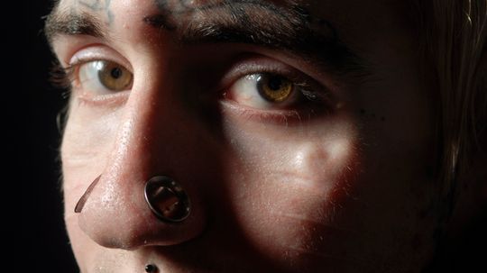 How Scleral Tattoos Work