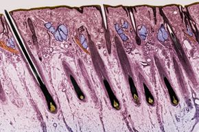 In this cross-section of the skin on the human scalp, you can pick out hair follicles, hairs, sweat glands and sebaceous glands, among other points of interest. The follicle all the way on the left, with its resident hair, is easy to see.