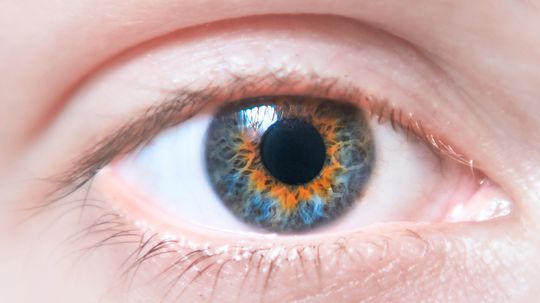 Central Heterochromia: When to Worry About Eye Color
