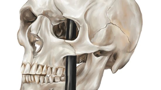 Phineas Gage and the Birth of Modern Neuroscience