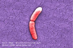 A single gram-negative Salmonella typhimurium bacterium caught in the act of cell division.