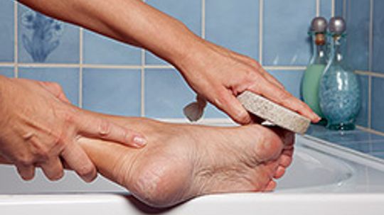 How to Get Rid of Dry Skin on Your Feet