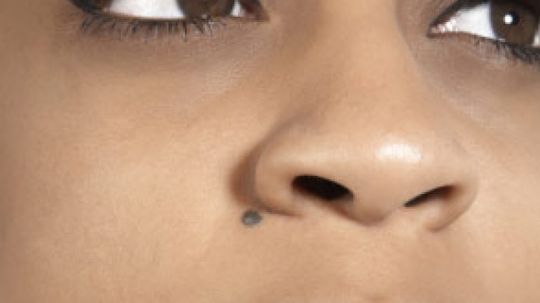 How Skin Moles Work