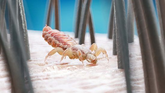 5 Parasites That Breed On and In Your Skin