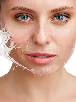 how to prevent your skin from peeling