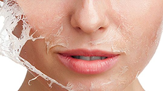 How to Stop Skin from Peeling on Your Face