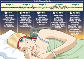 Dreaming occurs in the fifth stage of sleep.