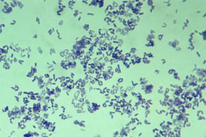 Corynebacterium is the pathogen that causes diphtheria.