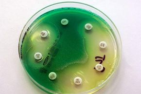 A petri dish with Pseudomonas aeruginosa is shown; this bacterium requires little nutrition and can tolerate a range of settings, including your smartphone.