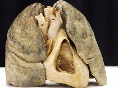 smoker's heart and lung