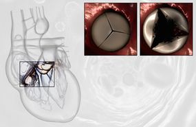 Diagram of the triscuspid heart valve