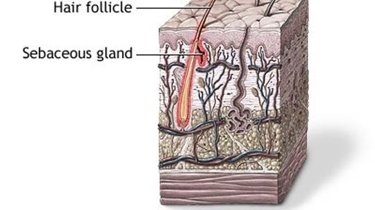 How does acne work?