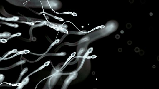 Men's Sperm Count Down Significantly, Study Finds
